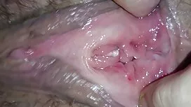 薄い皮膚がんと彼女はそれの中に終わった  ...